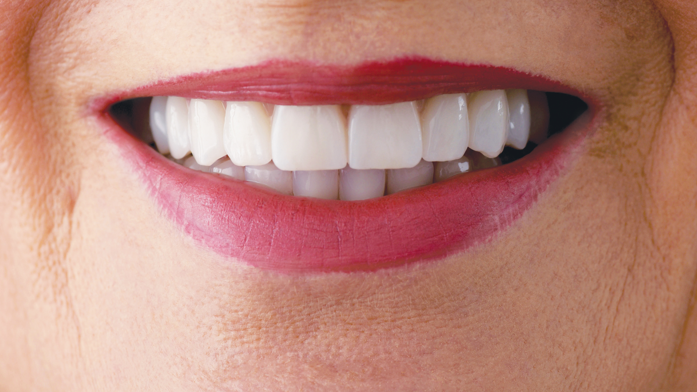 Donne e salute parodontale: Una ricorrenza per riflettere sulla salute orale femminile